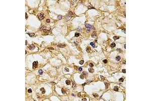 Immunohistochemical analysis of HUS1 staining in human kidney formalin fixed paraffin embedded tissue section. (HUS1 anticorps)