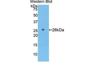Detection of Recombinant AZU1, Human using Polyclonal Antibody to Azurocidin (AZU)