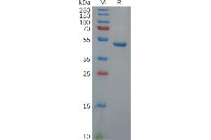 Human U Protein, hFc Tag on SDS-PAGE under reducing condition.