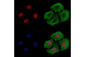 ABIN6260522 and ABIN6278786 staining Hela cells by IF/ICC. (CBX8 anticorps  (Internal Region))