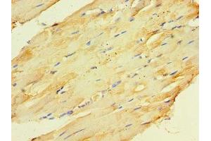 Immunohistochemistry of paraffin-embedded human skeletal muscle tissue using ABIN7148666 at dilution of 1:100 (CKMT2 anticorps  (AA 40-230))