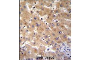 GAGE12B Antibody immunohistochemistry analysis in formalin fixed and paraffin embedded human liver tissue followed by peroxidase conjugation of the secondary antibody and DAB staining. (G Antigen 12B anticorps  (N-Term))