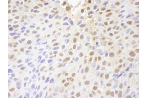 Immunohistochemistry (IHC) image for anti-Poly (ADP-Ribose) Polymerase Family, Member 10 (PARP10) (AA 300-350) antibody (ABIN7448715) (PARP10 anticorps  (AA 300-350))