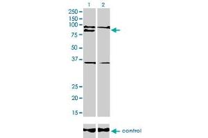 Western blot analysis of RNF141 over-expressed 293 cell line, cotransfected with RNF141 Validated Chimera RNAi (Lane 2) or non-transfected control (Lane 1).