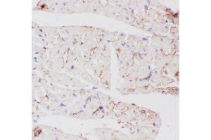 Anti-GLUT4 Picoband antibody,  IHC(P): Rat Cardiac Muscle Tissue