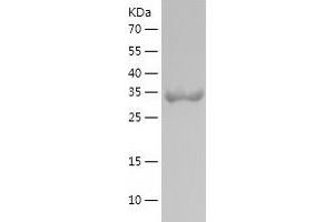 Western Blotting (WB) image for Glutathione Peroxidase 3 (Plasma) (GPX3) (AA 100-172) protein (His-IF2DI Tag) (ABIN7123129)