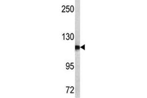 Western blot analysis of NPEPPS antibody and MCF-7 lysate. (NPEPPS anticorps  (AA 709-737))