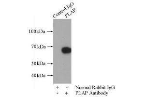 IP analysis of HepG2 cell lysates (1800 μg), using PLAP antibody (1/800 dilution). (PLAP anticorps)