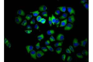 Immunofluorescence staining of Hela cells with ABIN7142862 at 1:133, counter-stained with DAPI.