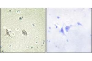 Immunohistochemistry analysis of paraffin-embedded human brain, using M-CSF Receptor (Phospho-Tyr723) Antibody. (CSF1R anticorps  (pTyr723))