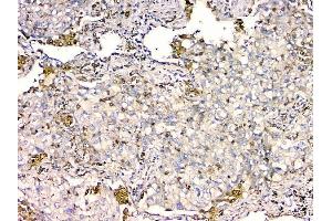 IHC analysis of GPX1 using anti GPX1 antibody (ABIN6719520). (Glutathione Peroxidase 1 anticorps  (Middle Region))