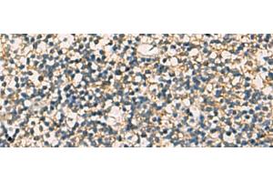 Immunohistochemistry of paraffin-embedded Human tonsil tissue using STX6 Polyclonal Antibody at dilution of 1:60(x200) (Syntaxin 6 anticorps)