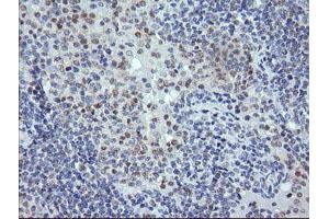 Image no. 4 for anti-Ring Finger Protein 39 (RNF39) antibody (ABIN1500723)