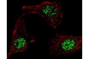 Fluorescent confocal image of HeLa cells stained with (ABIN389187 and ABIN2839350) KLF4 (N-term C74) antibody. (KLF4 anticorps  (AA 69-101))
