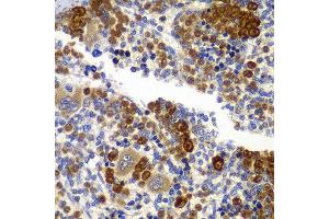 Immunohistochemistry of paraffin-embedded rat spleen using PRKAB1 antibody at dilution of 1:100 (x40 lens). (PRKAB1 anticorps)