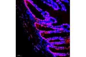 Immunofluorescence of paraffin embedded mouse colon using smad62024 (ABIN7075629) at dilution of 1:1000 (400x lens)