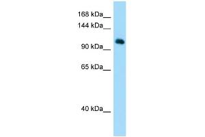 Host: Rabbit Target Name: MYSM1 Sample Type: Hela Whole Cell lysates Antibody Dilution: 1. (MYSM1 anticorps  (N-Term))