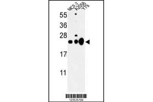 Western blot analysis of CBX1 Antibody in MCF-7, A2058, Y79 cell line lysates (35ug/lane) (CBX1 anticorps  (C-Term))
