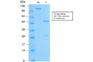 SDS-PAGE Analysis of Purified BCL2 Rabbit Recombinant Monoclonal Antibody ABIN6383843. (Recombinant Bcl-2 anticorps)