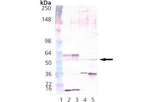 Western Blot Analysis of CaMKII: Lane 1: MWM, Lane 2: Brain (mouse), (tissue extract)  Lane 3:Brain (rat), (tissue extract)  Lane 4: HeLa, (cell lysate)  Lane 5: Hs-67 cell lysate. (CAMK2A anticorps  (N-Term))