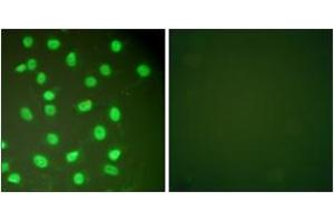 Immunofluorescence analysis of HepG2 cells, using MCM2 Antibody.