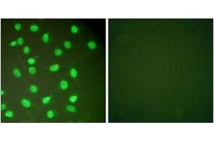 Immunofluorescence analysis of HepG2 cells, using MCM2 Antibody. (MCM2 anticorps  (AA 1-50))