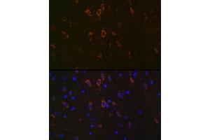 Immunofluorescence analysis of rat brain using Neurofilament H Rabbit mAb (ABIN7268866) at dilution of 1:100 (40x lens). (NEFH anticorps)