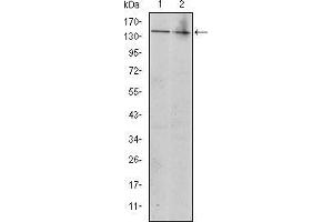 Western blot analysis using KIT mouse mAb against Jurkat (1) and Hela (2) cell lysate. (KIT anticorps)
