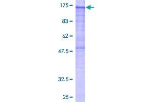 Image no. 1 for Phosphorylase Kinase, alpha 2 (PHKA2) (AA 1-1235) protein (GST tag) (ABIN1314916)