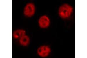 ABIN6269215 staining RAW264. (CDC25C anticorps  (Internal Region))