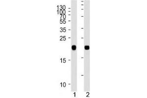 NRAS antibody western blot analysis in 1) human A431 and 2) rat C6 lysate.