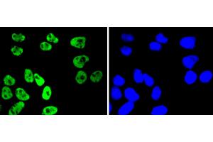 HeLa cells were stained with MSK1 (Ser376) (11A1) Monoclonal Antibody  at [1:200] incubated overnight at 4C, followed by secondary antibody incubation, DAPI staining of the nuclei and detection. (MSK1 anticorps  (pSer376))