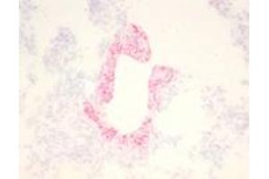 Immunohistochemical staining (Frozen Sections) of RSV-infected lung tissue (Guinea pig) (RSV anticorps)