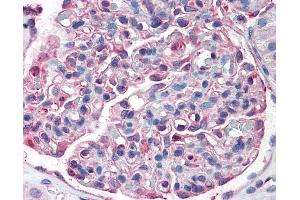 Anti-SLC39A14 antibody IHC of human kidney.