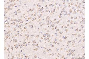 IHC analysis of RPL29 using anti-RPL29 antibody (ABIN7600993). (RPL29 anticorps  (AA 27-153))
