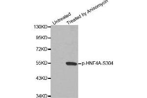 Western blot analysis of extracts from Hela cells, using Phospho-HNF4A-S304 antibody. (HNF4A anticorps  (pSer304))