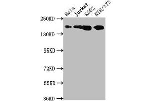 Western Blot Positive WB detected in: Hela whole cell lysate, Jurkat whole cell lysate, K562 whole cell lysate, NIH/3T3 whole cell lysate All lanes: TOP2A antibody at 1:1500 Secondary Goat polyclonal to rabbit IgG at 1/50000 dilution Predicted band size: 175, 178, 179, 183 kDa Observed band size: 175 kDa (Recombinant Topoisomerase II alpha anticorps)