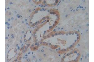 IHC-P analysis of Human Kidney Tissue, with DAB staining. (IGF2BP3 anticorps  (AA 2-343))