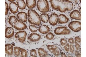 Immunoperoxidase of monoclonal antibody to PAK1 on formalin-fixed paraffin-embedded human stomach.