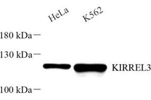 Western blot analysis of KIRREL3 (ABIN7074434) at dilution of 1: 2000 (KIRREL3 anticorps)