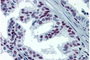Human Prostate: Formalin-Fixed, Paraffin-Embedded (FFPE) (SP1 anticorps  (AA 89-199))