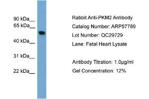 WB Suggested Anti-PKM2  Antibody Titration: 0. (PKM2 anticorps  (Middle Region))