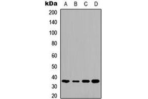 Western blot analysis of TMBIM1 expression in HeLa (A), HepG2 (B), mouse brain (C), rat kidney (D) whole cell lysates.