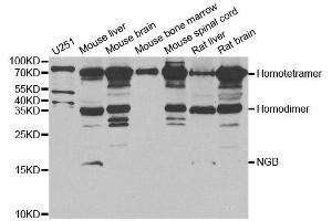 Western blot analysis of extracts of various cell lines, using NGB antibody. (Neuroglobin anticorps)