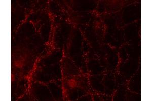 Indirect immunostaining of PFA fixed rat hippocampus neurons (dilution 1 : 500).