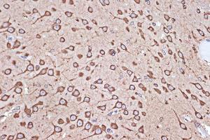 Immunohistochemistry of paraffin-embedded rat brain using eEF1G Rabbit mAb (ABIN7267024) at dilution of 1:100 (40x lens). (EEF1G anticorps)