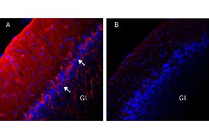 Immunohistochemical staining of perfusion-fixed frozen brain sections with Anti-KV1.