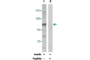 Western blot analysis of extracts from 293 cells, treated with insulin (0. (BRAF anticorps)