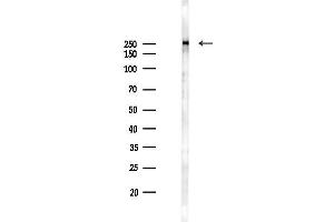 anti-CREB Binding Protein (CREBBP) (C-Term) antibody