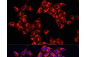 Immunofluorescence analysis of HeLa cells using ARHGAP1 Polyclonal Antibody at dilution of 1:100. (ARHGAP1 anticorps)